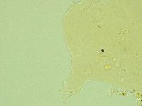 Pseudechiniscus novaezeelandiae image