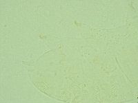 Pseudechiniscus suillus image