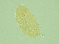 Pseudechiniscus novaezeelandiae image