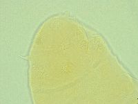 Pseudechiniscus novaezeelandiae image