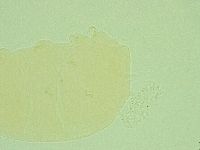 Pseudechiniscus novaezeelandiae image