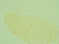 Pseudechiniscus novaezeelandiae image