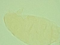 Pseudechiniscus novaezeelandiae image