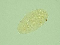 Pseudechiniscus novaezeelandiae image