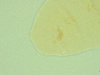 Pseudechiniscus novaezeelandiae image