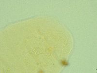 Pseudechiniscus novaezeelandiae image