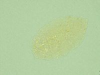 Pseudechiniscus novaezeelandiae image