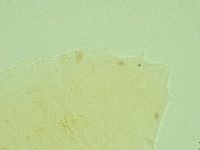 Pseudechiniscus novaezeelandiae image