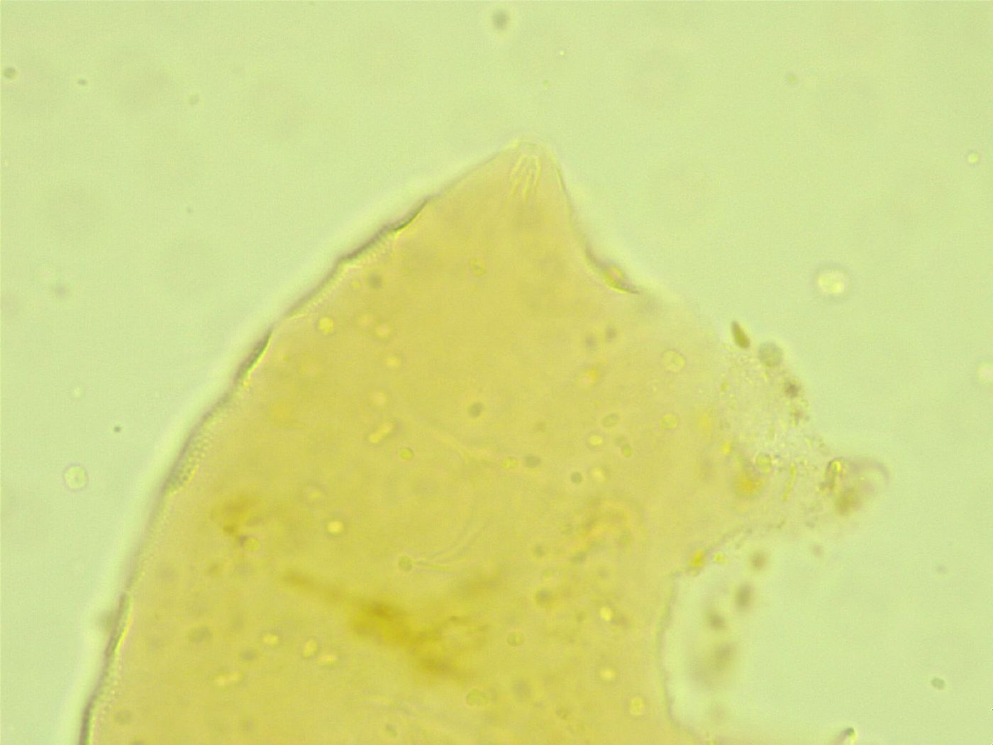 Pseudechiniscus juanitae image