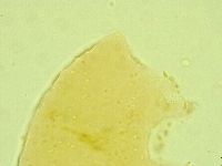 Pseudechiniscus juanitae image