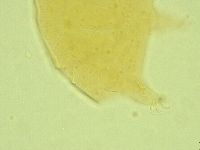 Pseudechiniscus juanitae image
