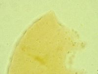 Pseudechiniscus juanitae image