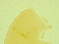 Pseudechiniscus juanitae image