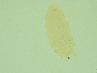 Pseudechiniscus juanitae image