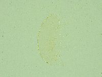 Pseudechiniscus juanitae image