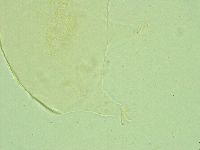 Pseudechiniscus juanitae image