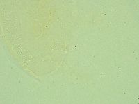 Pseudechiniscus juanitae image