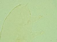 Pseudechiniscus juanitae image