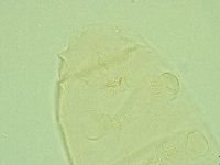 Pseudechiniscus juanitae image