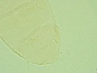 Pseudechiniscus juanitae image