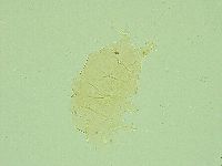 Pseudechiniscus juanitae image
