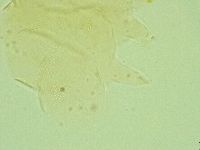 Pseudechiniscus juanitae image