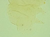 Pseudechiniscus juanitae image