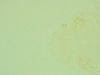 Pseudechiniscus novaezeelandiae image