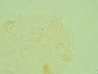 Pseudechiniscus novaezeelandiae image