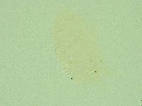 Pseudechiniscus novaezeelandiae image