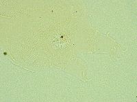Pseudechiniscus novaezeelandiae image