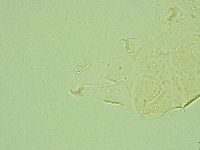 Pseudechiniscus novaezeelandiae image