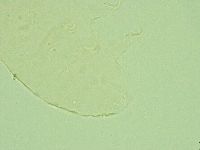 Pseudechiniscus novaezeelandiae image