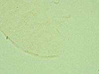 Pseudechiniscus novaezeelandiae image