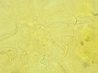 Cornechiniscus lobatus image
