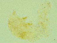 Pseudechiniscus novaezeelandiae image
