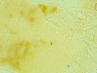 Pseudechiniscus novaezeelandiae image