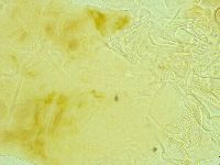 Pseudechiniscus novaezeelandiae image