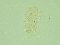 Pseudechiniscus juanitae image
