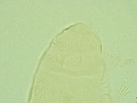 Pseudechiniscus juanitae image