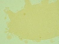 Pseudechiniscus juanitae image