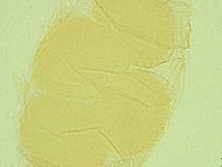 Pseudechiniscus juanitae image
