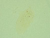 Pseudechiniscus novaezeelandiae image
