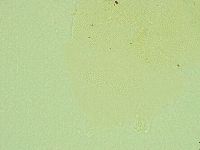 Pseudechiniscus novaezeelandiae image