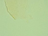 Pseudechiniscus novaezeelandiae image