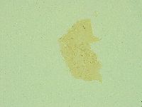 Pseudechiniscus juanitae image