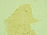 Pseudechiniscus juanitae image