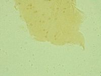 Pseudechiniscus juanitae image