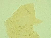 Pseudechiniscus juanitae image