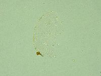 Pseudechiniscus juanitae image
